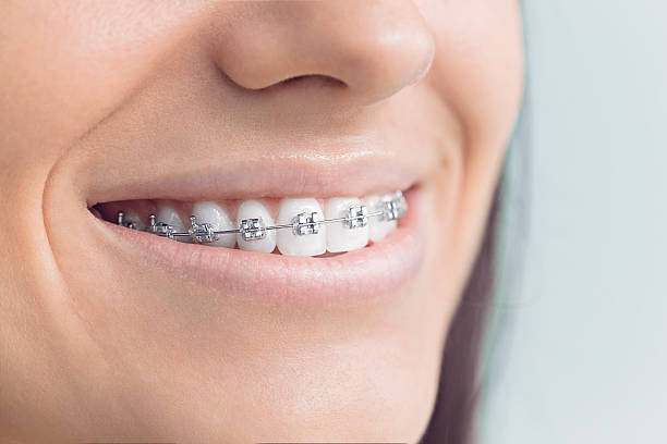 Best Teeth Whitening  in Rising Sun Lebanon, DE